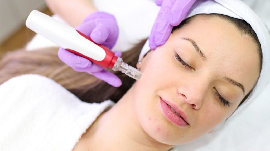 Microneedling facial young woman gets skin care treatment