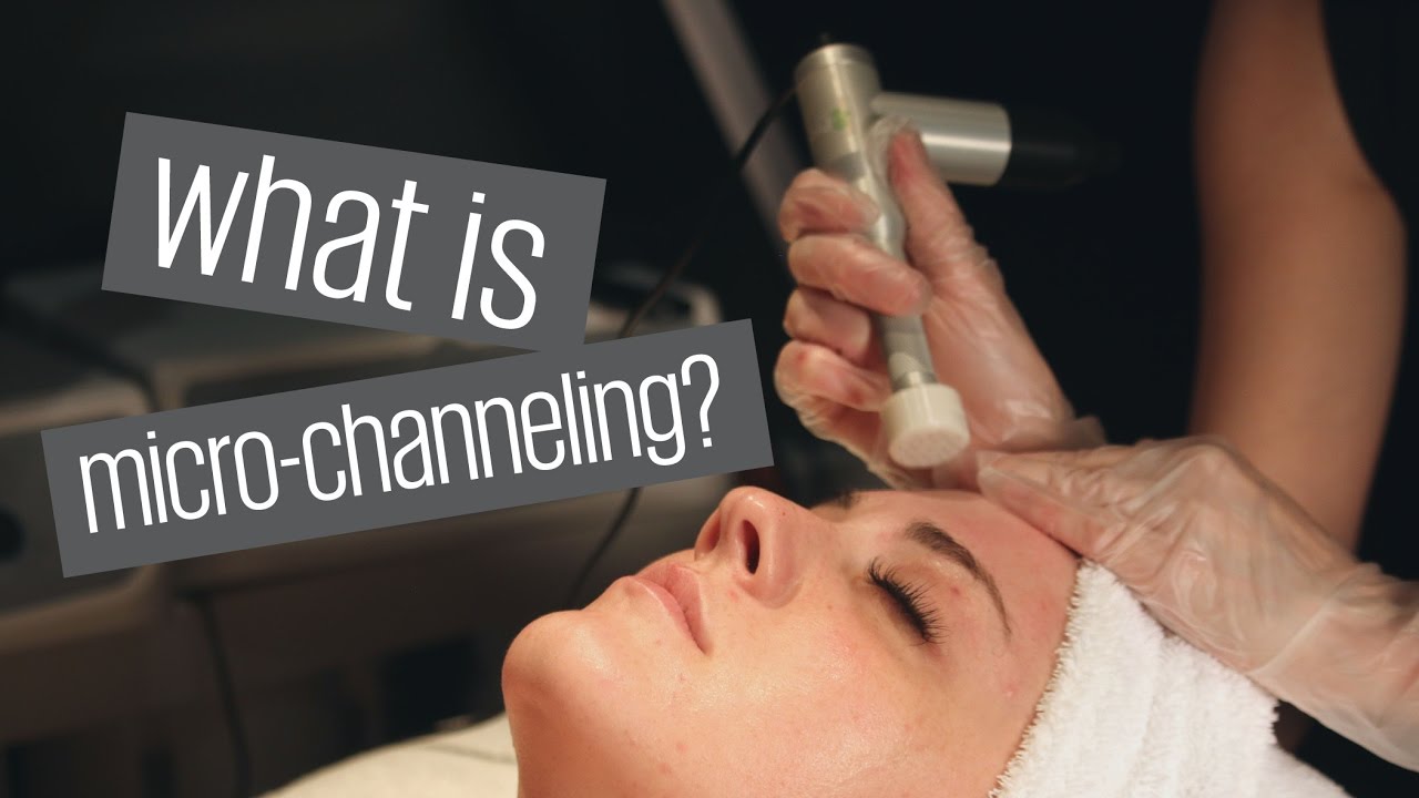 procell microchanneling microneedling