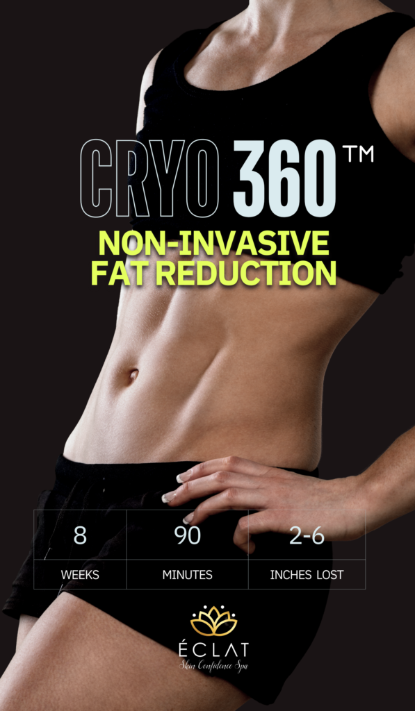 cryo360